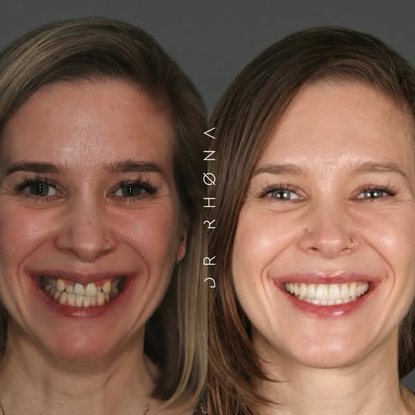 Dr Rhona Eskander ad