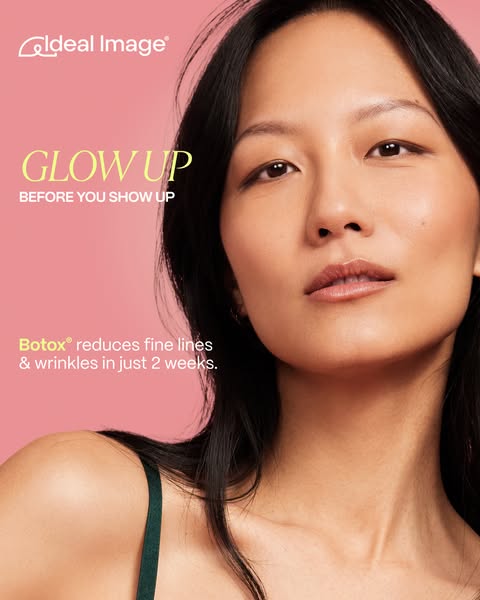 This image ad for Ideal Image promotes Botox treatments, highlighting the benefit of reducing fine lines and wrinkles in