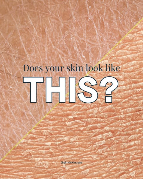 Dr Sandra Lee aka drpimplepopper ad