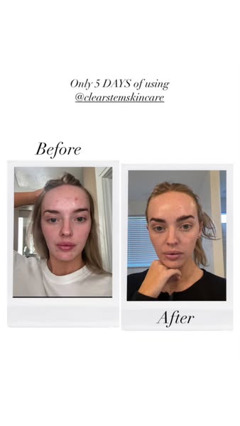 Camille Munday ad