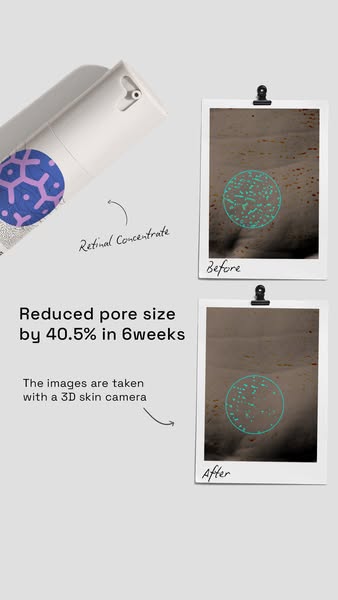 This ad showcases a skincare product, a retinal concentrate, and its effect on reducing pore size. It uses before-and-af