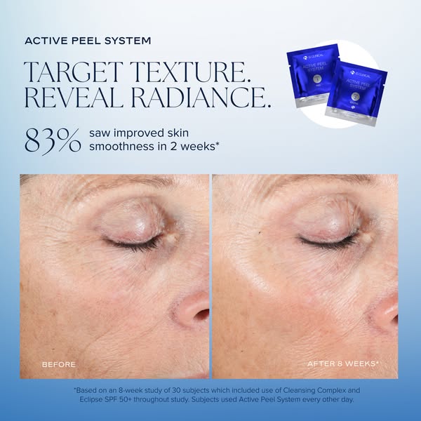 This ad for iS Clinical's Active Peel System uses a before and after image to demonstrate the product's effectiv