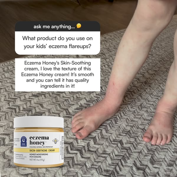This ad features a testimonial for Eczema Honey's Skin-Soothing Cream. It uses the format of an Instagram question a