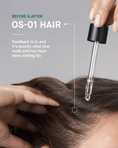 The ad showcases the OS-01 HAIR product through a close-up shot of someone applying the product to their scalp. The text