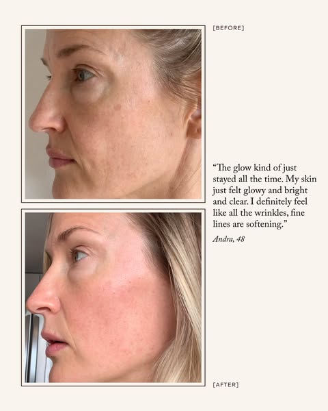 This image ad uses before and after photos along with a customer testimonial to showcase the effectiveness of a product