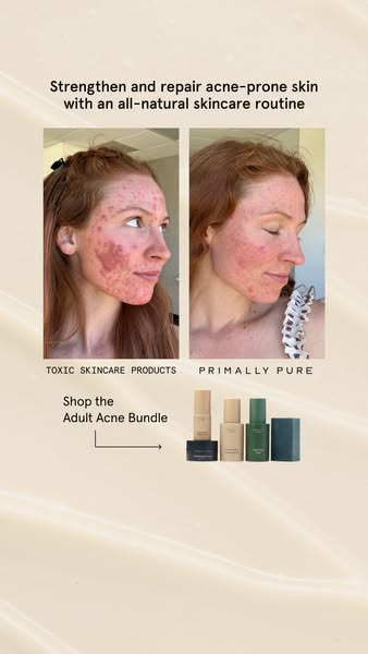 Grace Lauren Harvey ad