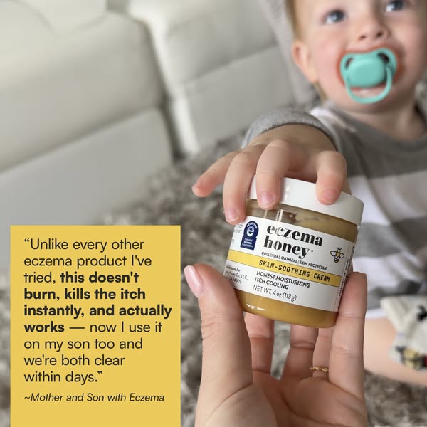 This ad features a mother attesting to the efficacy of Eczema Honey's Skin-Soothing Cream. She highlights its abilit