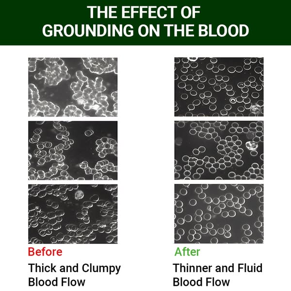 This ad shows microscope images of blood before and after grounding, suggesting that grounding leads to thinner and more