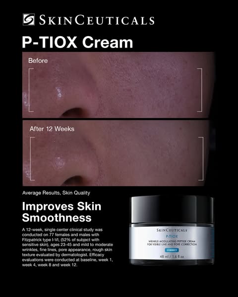 The ad promotes SkinCeuticals P-TIOX Cream with before-and-after photos showing improvements in skin smoothness after 12