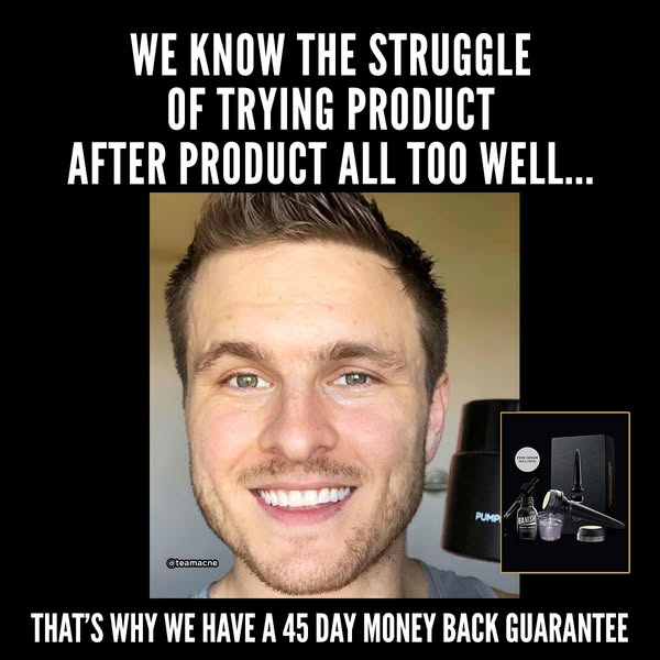 This image ad highlights the frustration of trying multiple acne products without success and positions the brand's 