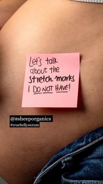 The image ad features a person without visible stretch marks and a message on a pink sticky note that reads, "Let&#