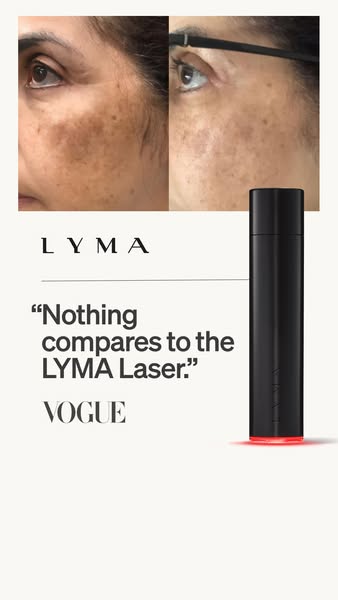 This ad features a before and after photo of a woman's face, highlighting the LYMA Laser's ability to reduce dar