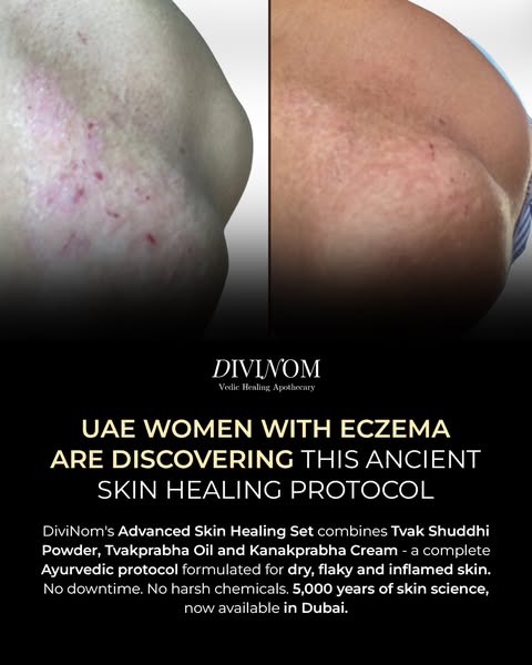 Ayesha Depala ad