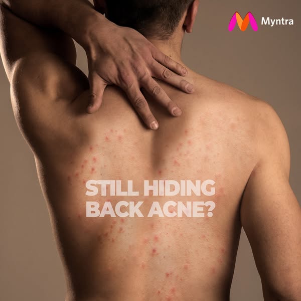 This ad highlights a common skin concern, back acne, and encourages viewers to address it.