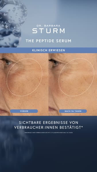 This Meta image ad for Dr. Barbara Sturm's The Peptide Serum shows a before and after of a woman's face using th