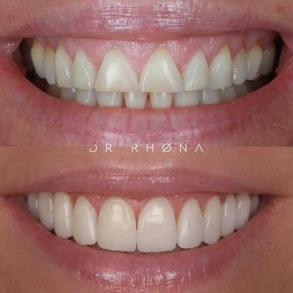 Dr Rhona Eskander ad