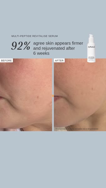 Image ad for Alpha-H Multi-Peptide Revitalise Serum. The ad uses a split screen showing the 'before' and 'af