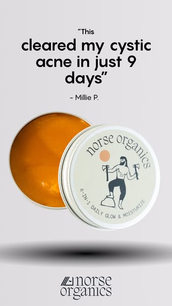 This ad features an acne treatment product by Norse Organics. The product is showcased next to an opened tin with a quot