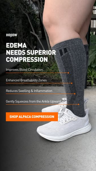 This ad promotes Hojiow alpaca compression socks as a solution for edema. The ad shows a close-up of a leg wearing the s