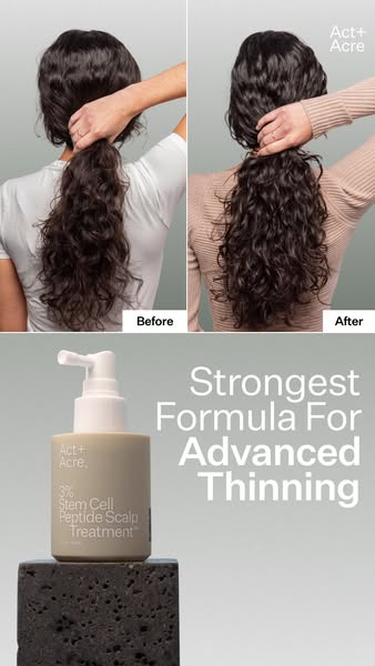 This ad compares the appearance of hair before and after using Act+Acre's Stem Cell Peptide Scalp Treatment. It emph
