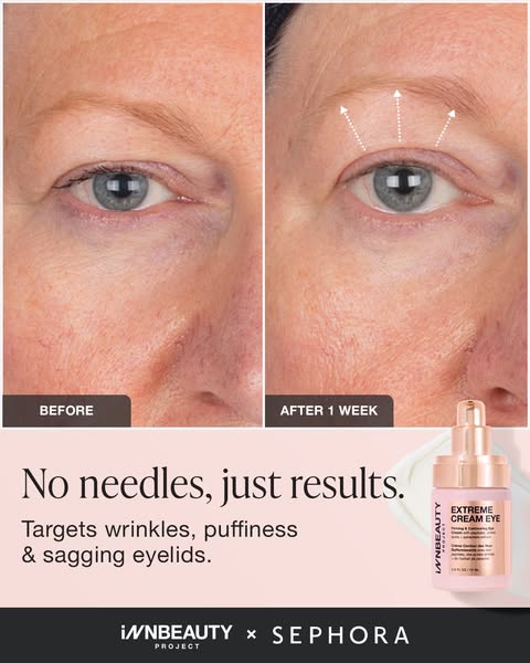 This image ad showcases the InnBeauty Project Extreme Cream Eye in a before-and-after format. The ad highlights the prod