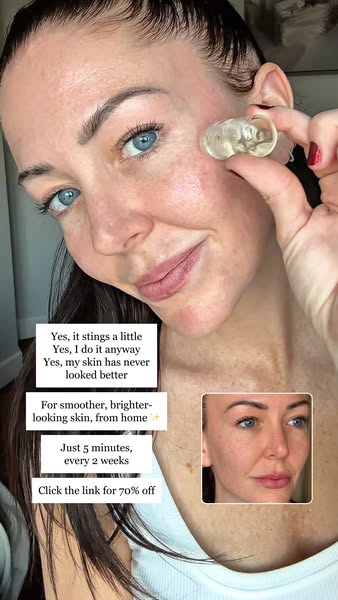 HOLLY ALLEN ad