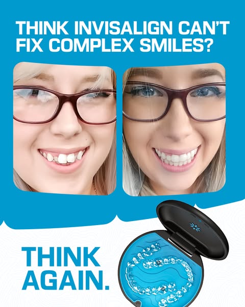This ad for Invisalign addresses concerns about complex smiles. It features a before-and-after photo of a woman's te