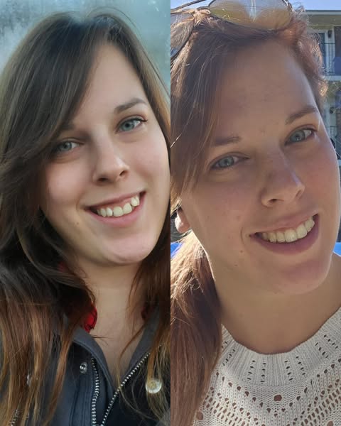 This ad shows a before and after photo of the same person's smile, presumably to highlight the effectiveness of a de