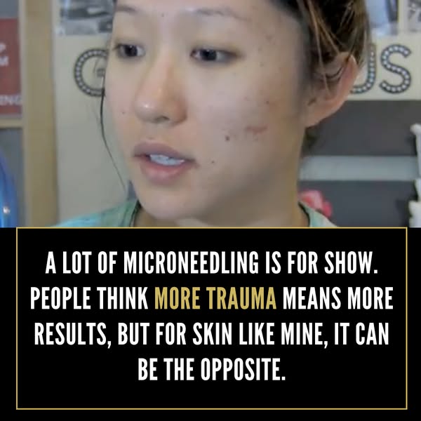 An image ad showing an individual with some minor skin blemishes, along with a text overlay that claims that a lot of mi