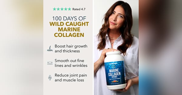 Lisa Snowdon ad