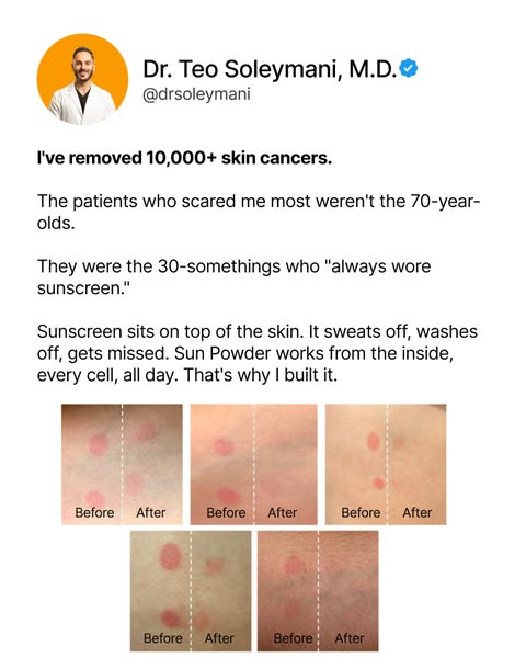 Teo Soleymani, M.D. ad