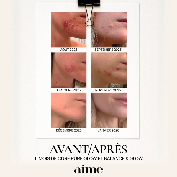 This image ad shows a before and after of a woman's skin, from August 2025 to January 2026, after a 6-month treatmen