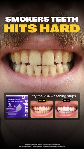 Hismile ad