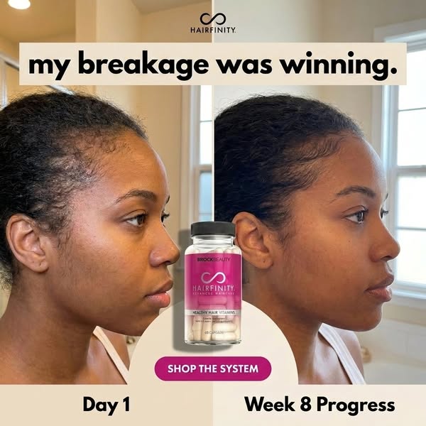 This image ad compares before and after photos of a woman's hairline to show the effectiveness of Hairfinity vitamin