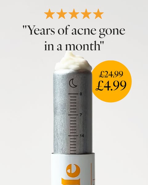 This image ad features a testimonial for a product that treats acne. The ad presents the problem the product solves (acn