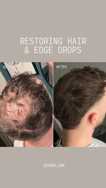 This ad showcases a before and after image of a man's head with thinning hair and how hair restoring drops can help 