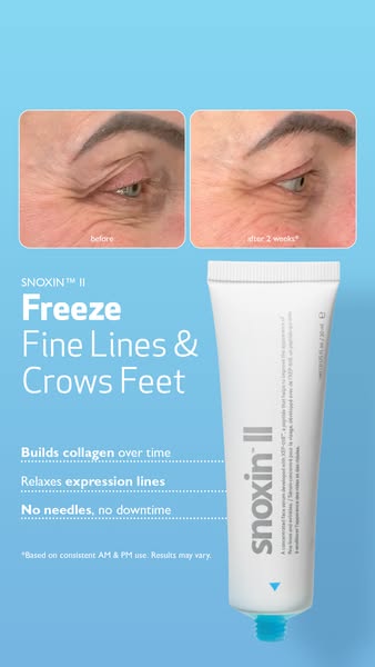 This ad is for Snoxin II, a face serum that helps improve the appearance of fine lines and wrinkles. The ad features a b