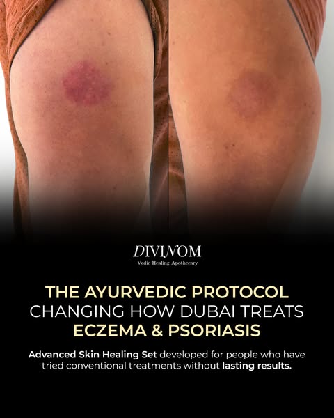 Ayesha Depala ad