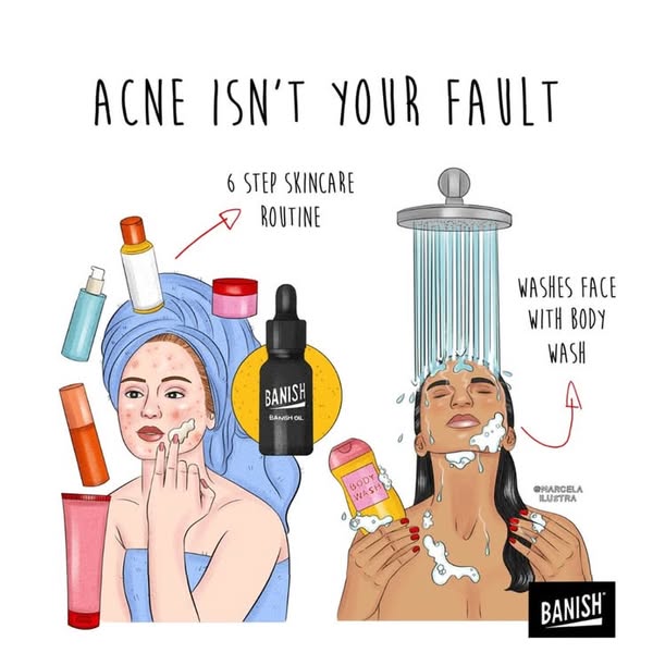 An illustration contrasts a woman's skincare routine using the Banish acne skincare line versus washing the face wit